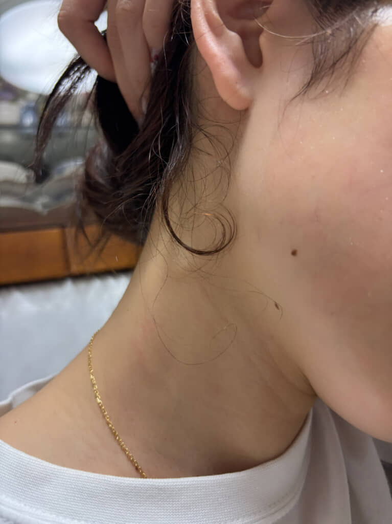 ママさんのえり足にも同じクセを発見!
