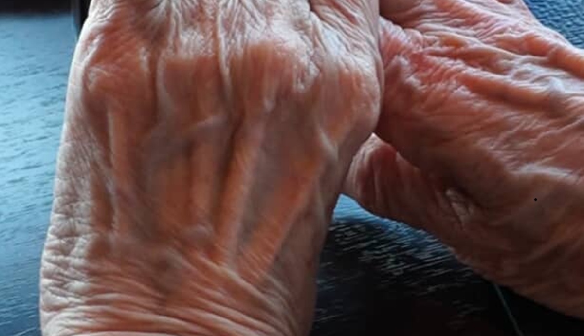 89歳大叔母が50年前に作った“ミキモトの指輪”→着けてみたら…… 驚きの姿に「センスに脱帽」「なんと素敵な手」(1/2) | 女性 ねとらぼ