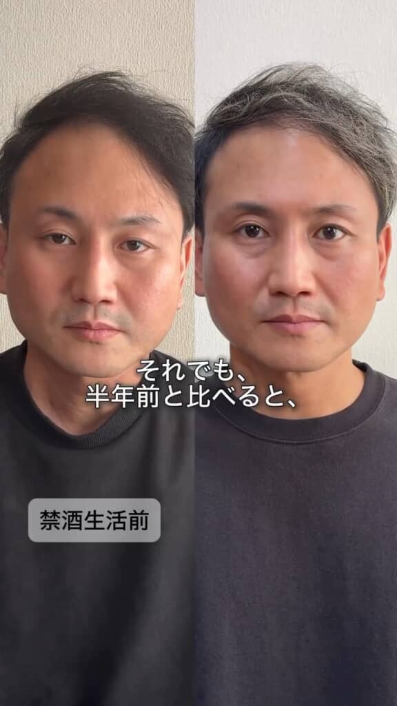 禁酒前と禁酒後の比較