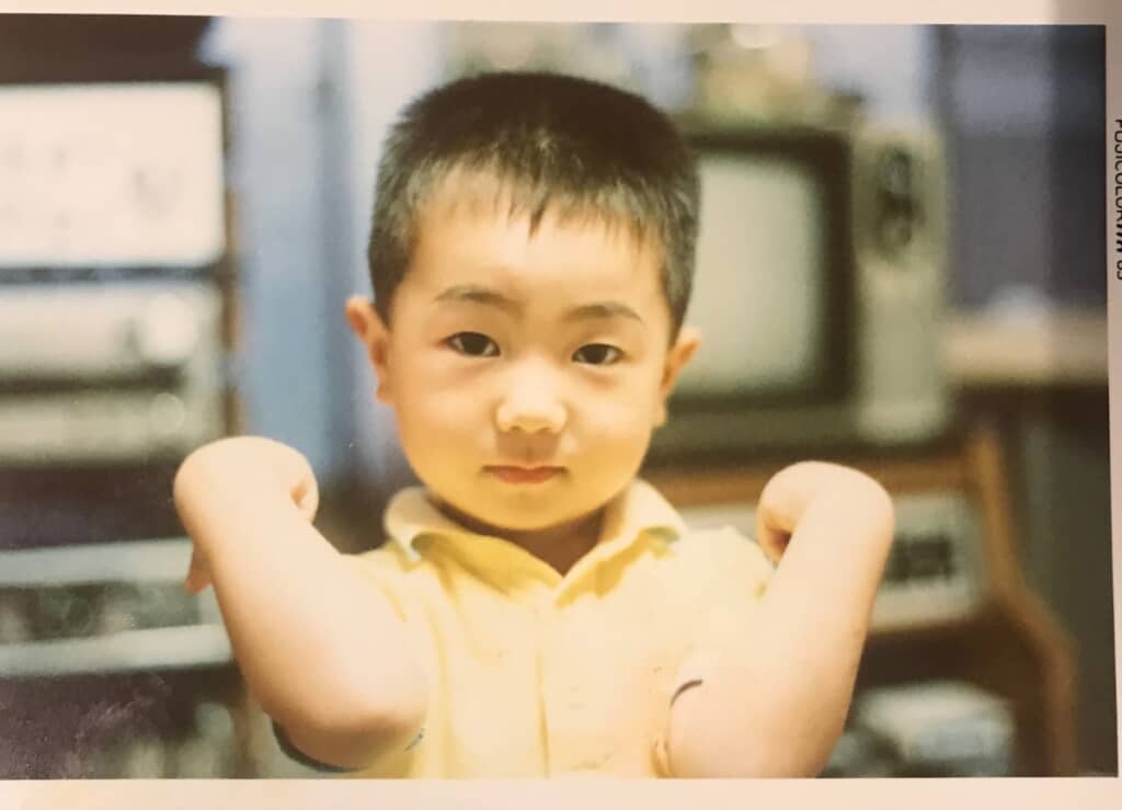 髪がふさふさな幼少期の阿蘇さん