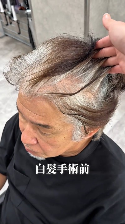 施術前の男性