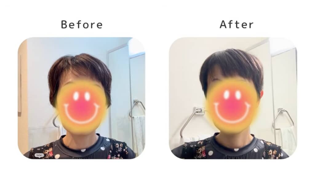 ビフォーアフター(正面)