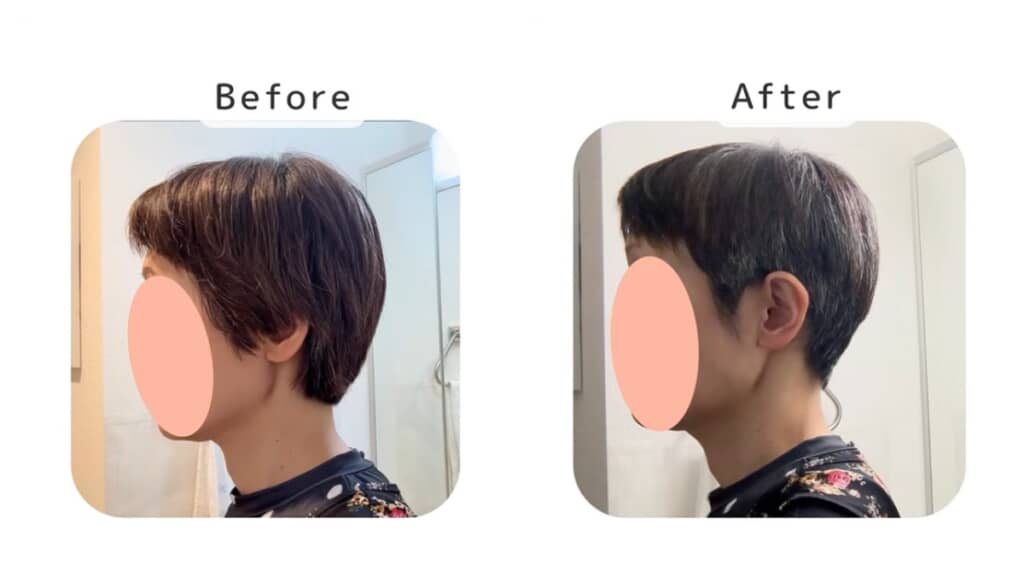 ビフォーアフター(サイド)