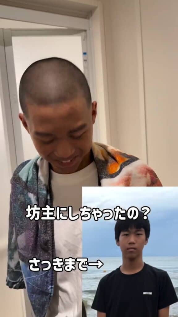 ビフォーアフターに母も衝撃