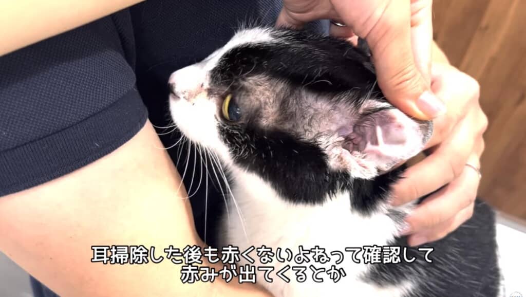 耳掃除後のチェックもしっかり行いましょう